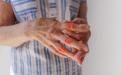 Consells per a la persona amb artrosi